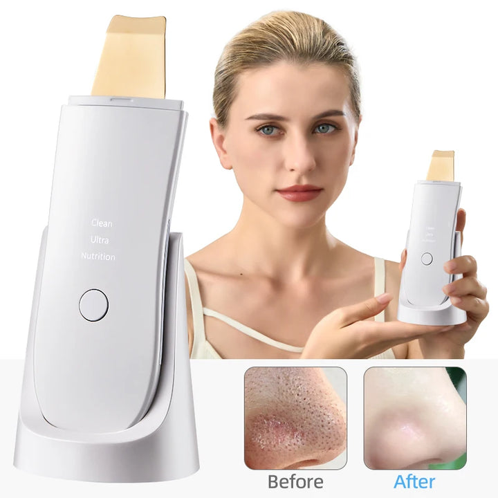 Skin Care Ultrasonic washing machine vibration shaving shovel blackhead removal shovel clean holes to remove dead facial lifting