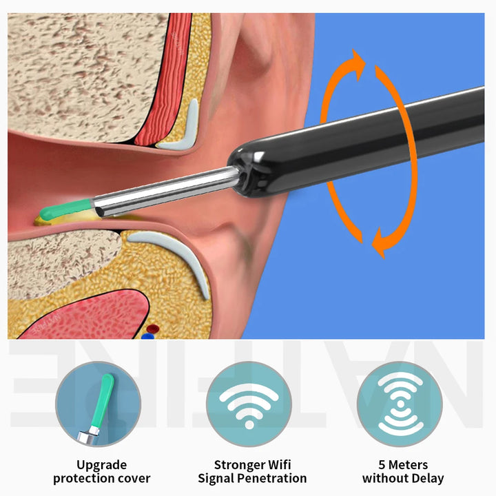 Limpador de ouvido visual inteligente HD Ear Sticks Otoscópio USB C Carregamento Endoscópio Ferramenta de remoção de cera Earpick Mini Camera Conjunto de cuidados de saúde